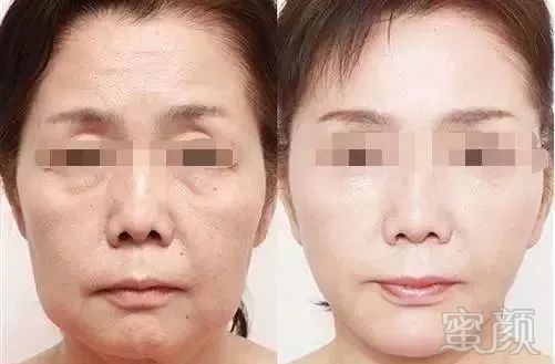 https://img.miyanlife.com/mnt/timg/180728/1113055Q2-6.jpg
