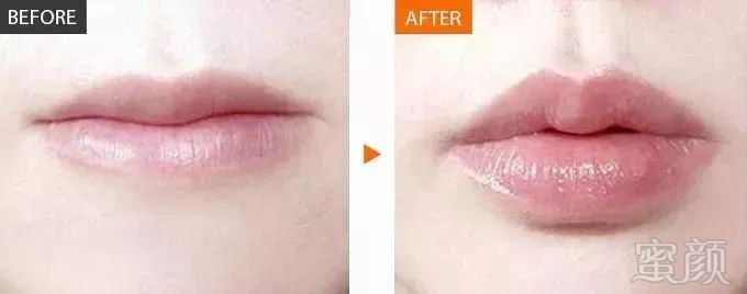 https://img.miyanlife.com/mnt/timg/180728/111305E28-7.jpg