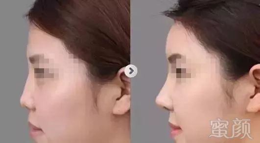 https://img.miyanlife.com/mnt/timg/180728/11130611K-9.jpg