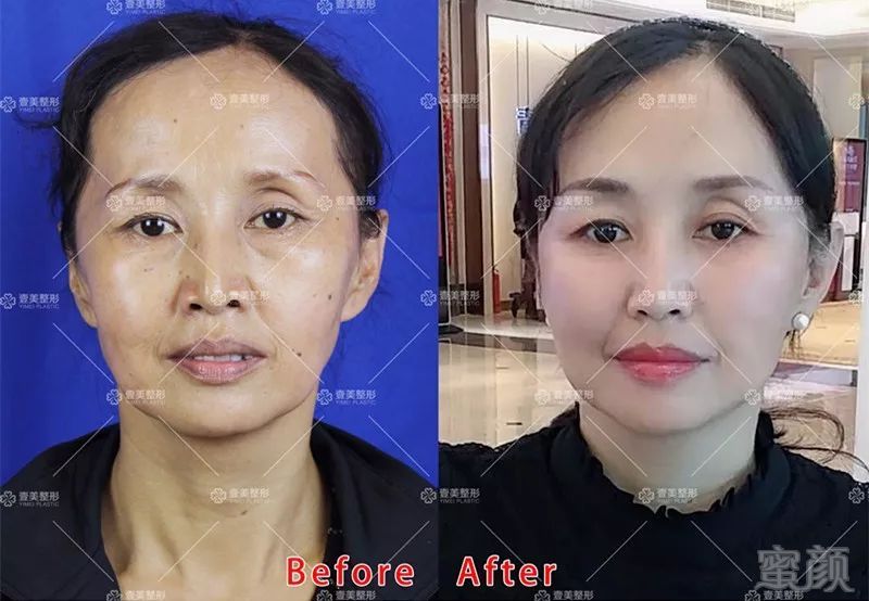 https://img.miyanlife.com/mnt/timg/180728/1122333348-6.jpg