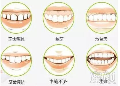 https://img.miyanlife.com/mnt/timg/180728/11233943X-6.jpg