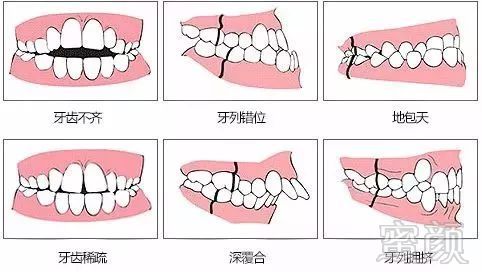 案例图片