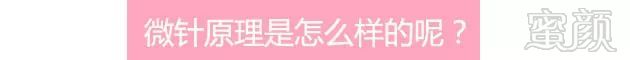 https://img.miyanlife.com/mnt/timg/180728/112A13a7-6.jpg