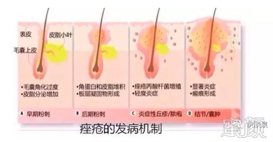 https://img.miyanlife.com/mnt/timg/180728/112A42202-14.jpg