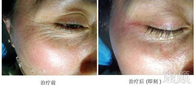 https://img.miyanlife.com/mnt/timg/180728/112I221Z-8.jpg
