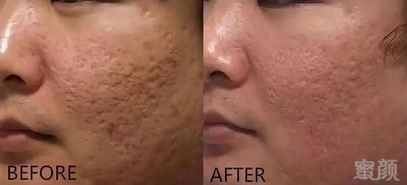 https://img.miyanlife.com/mnt/timg/180728/112I26051-10.jpg