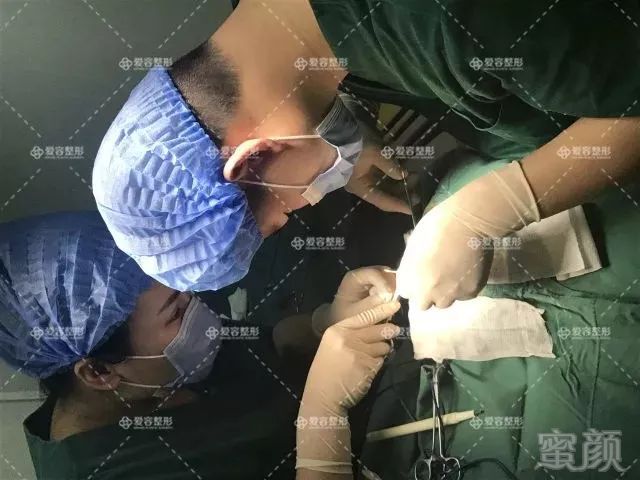 https://img.miyanlife.com/mnt/timg/180728/112S342E-3.jpg