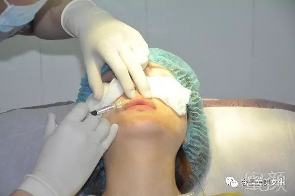 https://img.miyanlife.com/mnt/timg/180728/11353313c-1.jpg