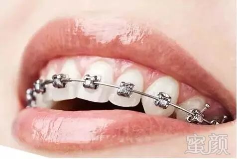 https://img.miyanlife.com/mnt/timg/180728/113A054Q-4.jpg