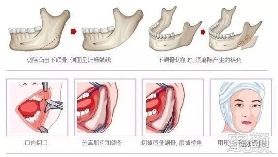 https://img.miyanlife.com/mnt/timg/180729/112I41363-0.jpg