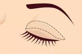 https://img.miyanlife.com/mnt/timg/180729/112T03P5-4.jpg