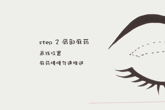 https://img.miyanlife.com/mnt/timg/180729/112T12347-10.jpg