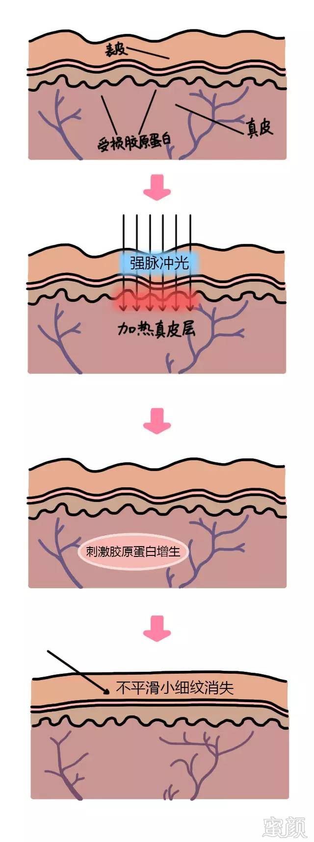 https://img.miyanlife.com/mnt/timg/180729/11315362W-4.jpg