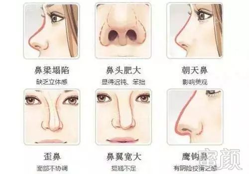 https://img.miyanlife.com/mnt/timg/180729/113K45930-2.jpg