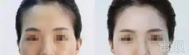 https://img.miyanlife.com/mnt/timg/180729/1146243500-7.jpg