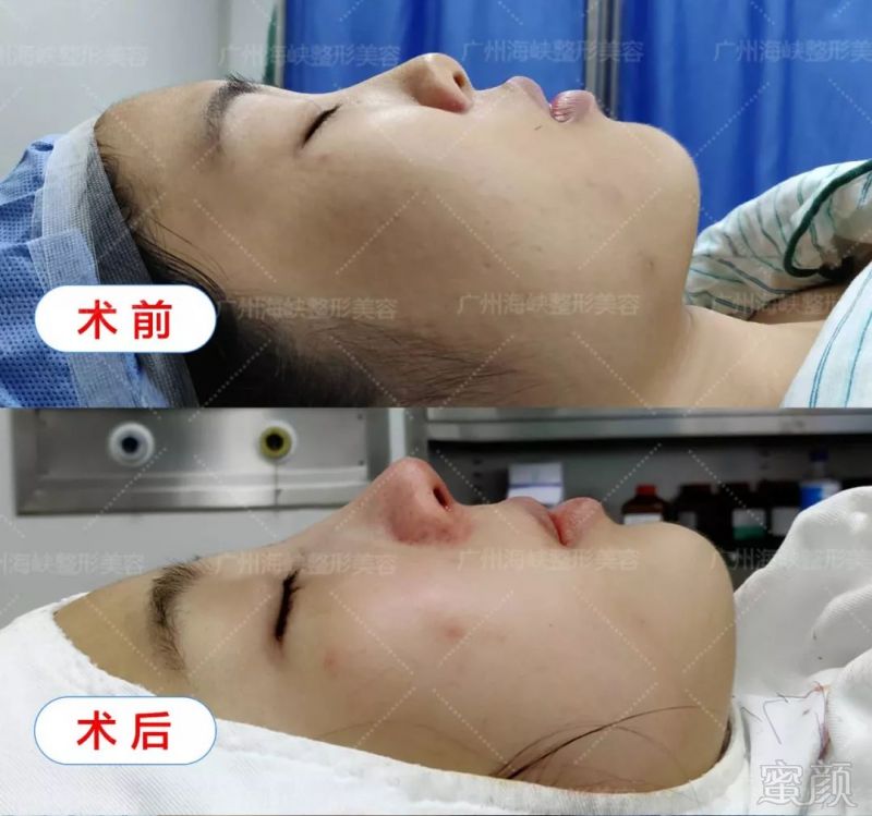 https://img.miyanlife.com/mnt/timg/180729/114J01962-15.jpg