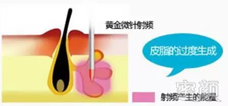 https://img.miyanlife.com/mnt/timg/180729/120353G40-9.jpg