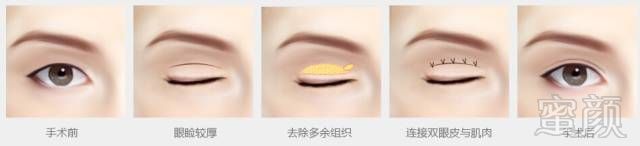 https://img.miyanlife.com/mnt/timg/180729/1205412Q7-1.jpg