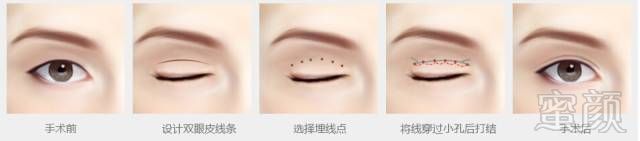https://img.miyanlife.com/mnt/timg/180729/1205413108-3.jpg