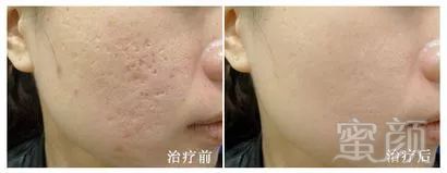 https://img.miyanlife.com/mnt/timg/180729/12064960H-10.jpg