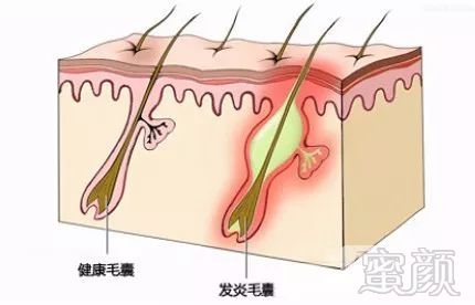 案例图片