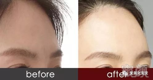 https://img.miyanlife.com/mnt/timg/180729/1219441U6-1.jpg