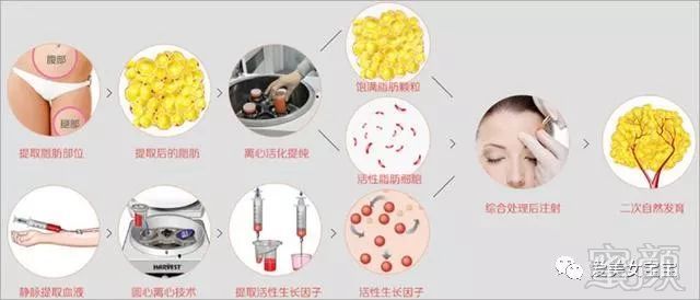https://img.miyanlife.com/mnt/timg/180729/12194435R-0.jpg
