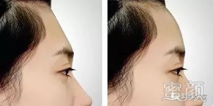 https://img.miyanlife.com/mnt/timg/180729/1219451952-2.jpg