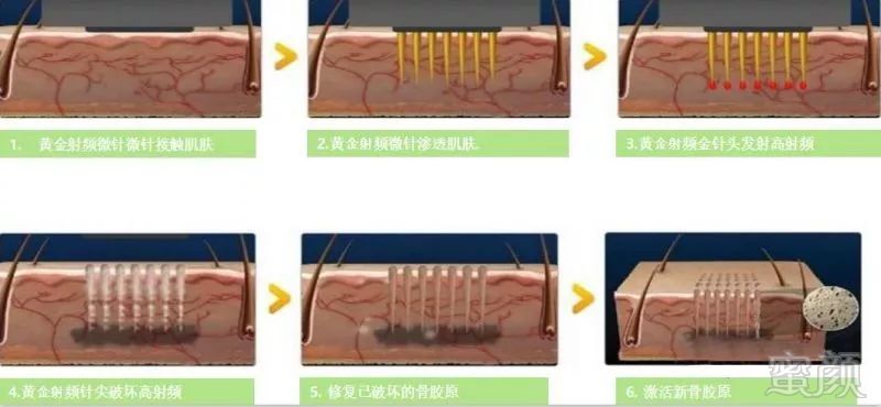 https://img.miyanlife.com/mnt/timg/180729/121T12045-4.jpg