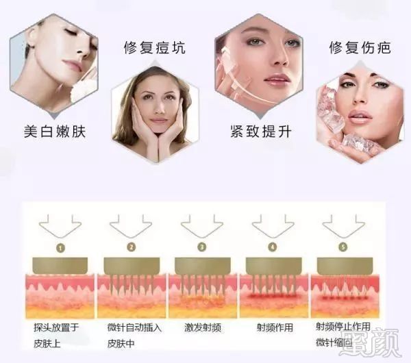 https://img.miyanlife.com/mnt/timg/180729/121T52925-10.jpg