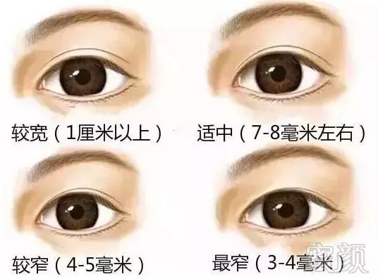 https://img.miyanlife.com/mnt/timg/180729/12351211P-7.jpg