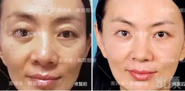 https://img.miyanlife.com/mnt/timg/180729/1243555447-7.jpg