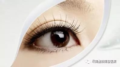 https://img.miyanlife.com/mnt/timg/180730/1126412464-0.jpg