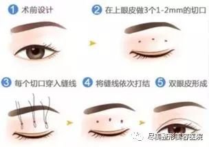 https://img.miyanlife.com/mnt/timg/180730/1126453533-11.jpg