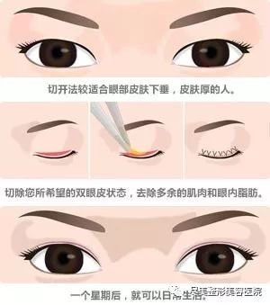 https://img.miyanlife.com/mnt/timg/180730/11264545a-10.jpg