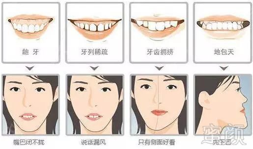 https://img.miyanlife.com/mnt/timg/180730/112P46406-0.jpg