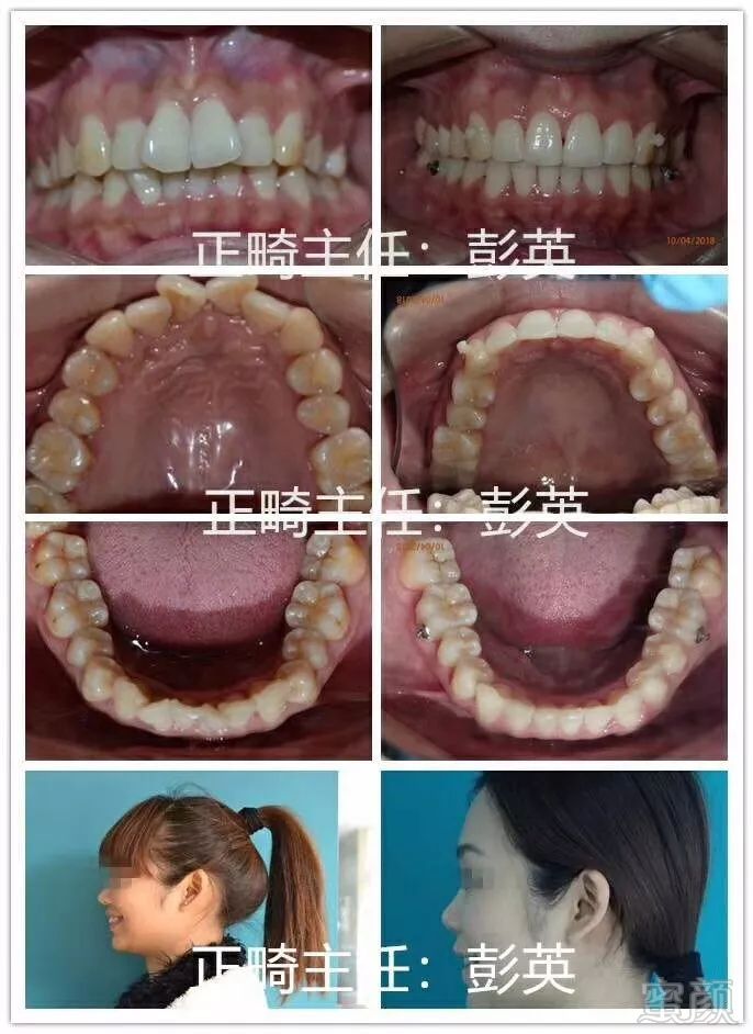 https://img.miyanlife.com/mnt/timg/180730/112P5C54-2.jpg