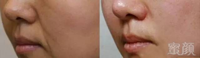 https://img.miyanlife.com/mnt/timg/180730/114003CT-3.jpg