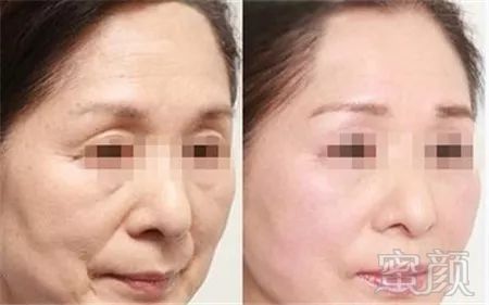 https://img.miyanlife.com/mnt/timg/180730/114Z2A47-4.jpg