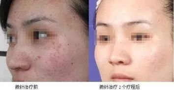 https://img.miyanlife.com/mnt/timg/180730/114Z2M12-3.jpg