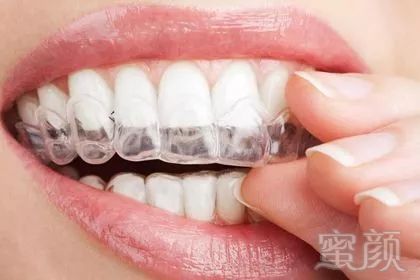 https://img.miyanlife.com/mnt/timg/180730/12021T022-2.jpg