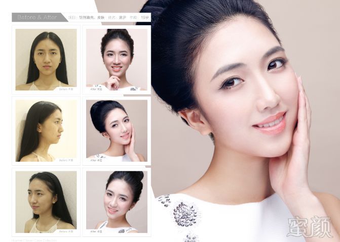 https://img.miyanlife.com/mnt/timg/180730/1204151060-2.jpg