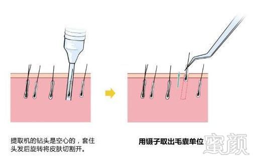 案例图片