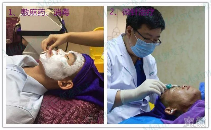 https://img.miyanlife.com/mnt/timg/180730/121Z63409-1.jpg