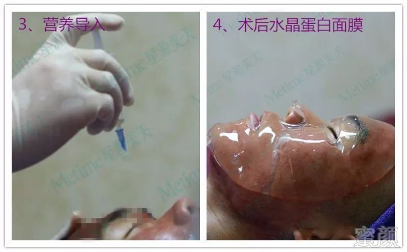 https://img.miyanlife.com/mnt/timg/180730/121Z63449-2.jpg