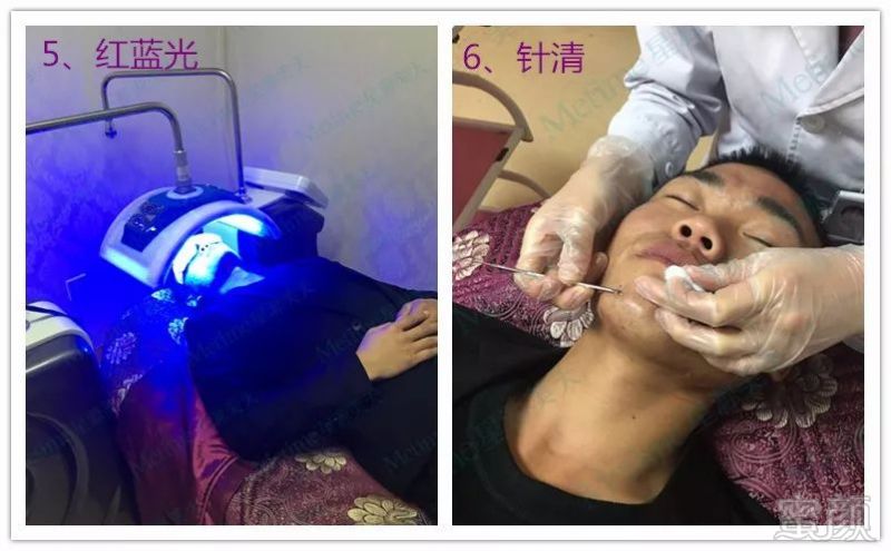 https://img.miyanlife.com/mnt/timg/180730/121ZJ513-3.jpg