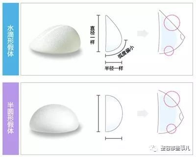 https://img.miyanlife.com/mnt/timg/180730/122I11Q3-0.jpg