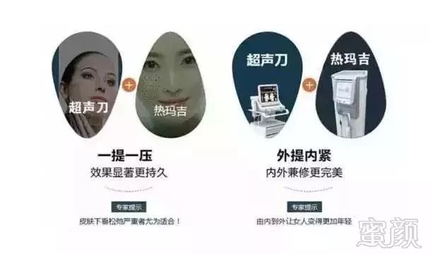 https://img.miyanlife.com/mnt/timg/180730/122S21c9-1.jpg