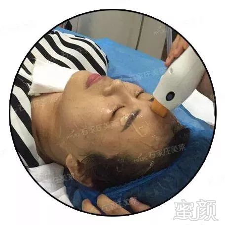 https://img.miyanlife.com/mnt/timg/180730/122S64225-4.jpg