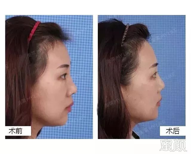 https://img.miyanlife.com/mnt/timg/180730/122SLH7-7.jpg